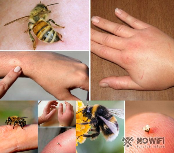 Как выглядит укус пчелы