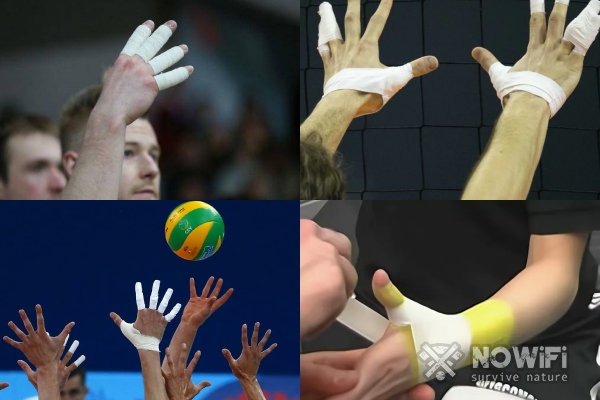 Как зафиксировать палец на руке перед волейболом